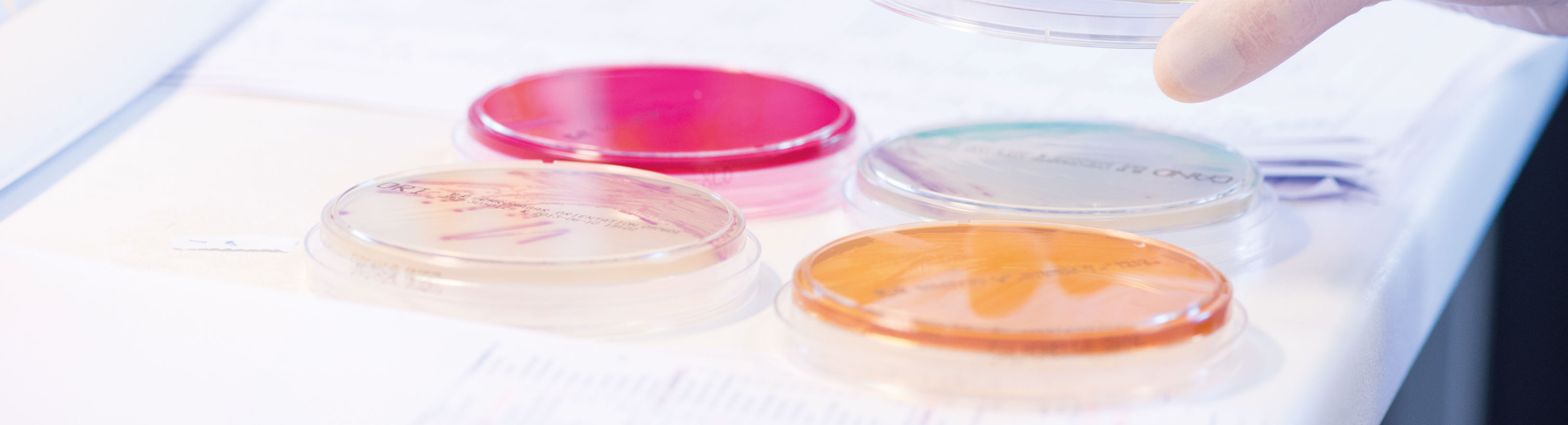 Vier Petrischalen mit verschiedenfarbigen Nährböden – rot, orange und zwei transparente – liegen auf einer weißen Fläche. Eine behandschuhte Hand hält den Deckel einer Schale. Im Hintergrund sind teilweise Dokumente zu sehen.