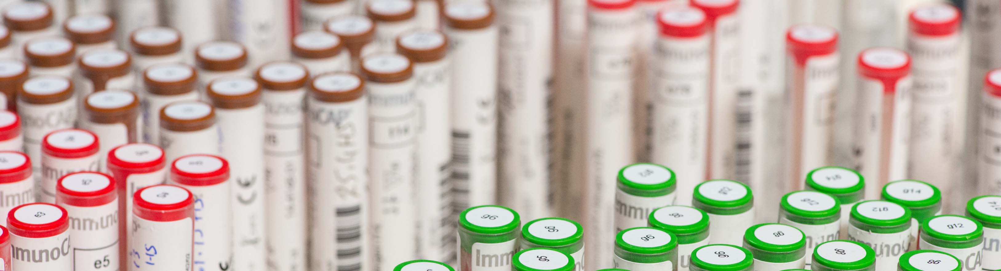 Mehrere beschriftete Test­röhrchen mit verschiedenfarbigen Deckeln – rot, grün und braun – sind zu sehen. Die Etiketten tragen Barcodes und Begriffe wie ‚ImmunoCAP‘ sowie alphanumerische Codes wie ‚e5‘, ‚g6‘ und ‚q4‘.
